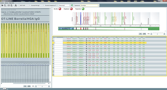 Immunoblot Software